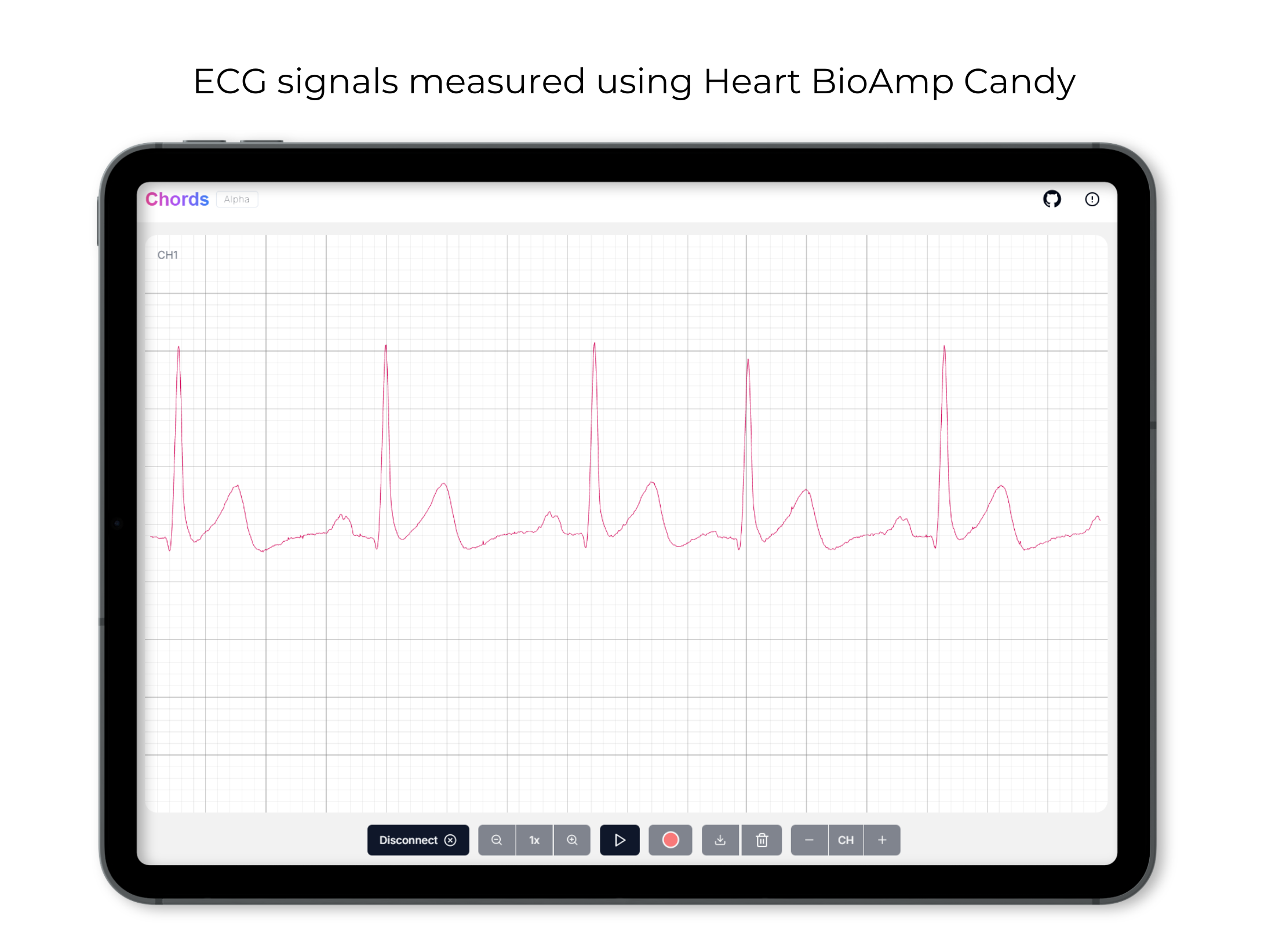 Sinyal ECG menggunakan Heart BioAmp Candy